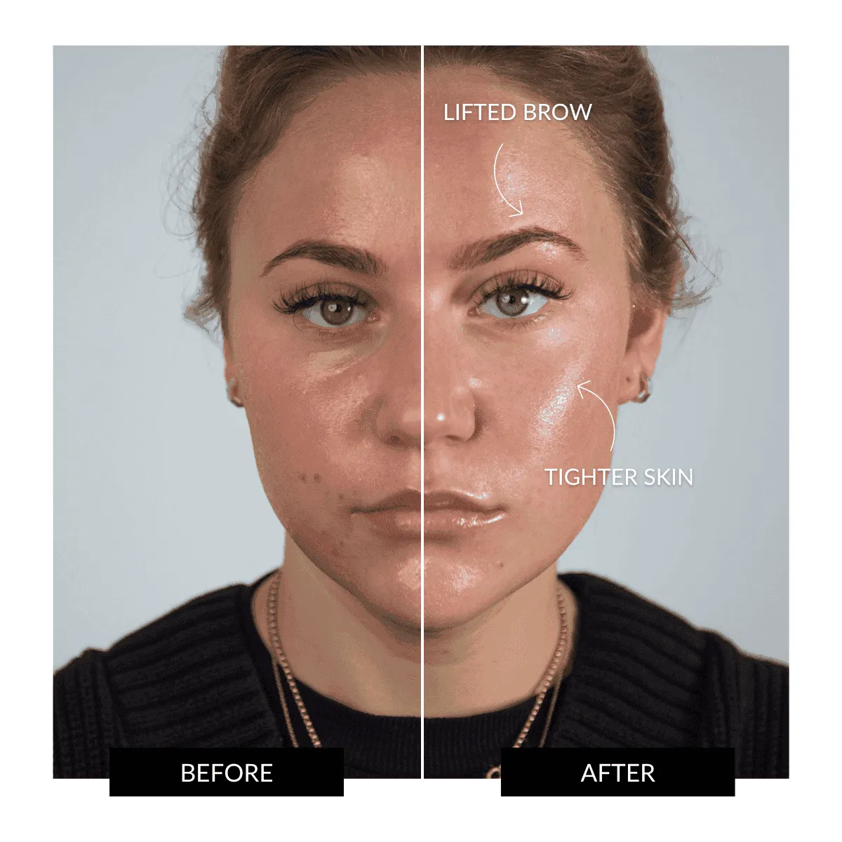 Offer - ZIIP HALO Nanocurrent Facial Toning Device