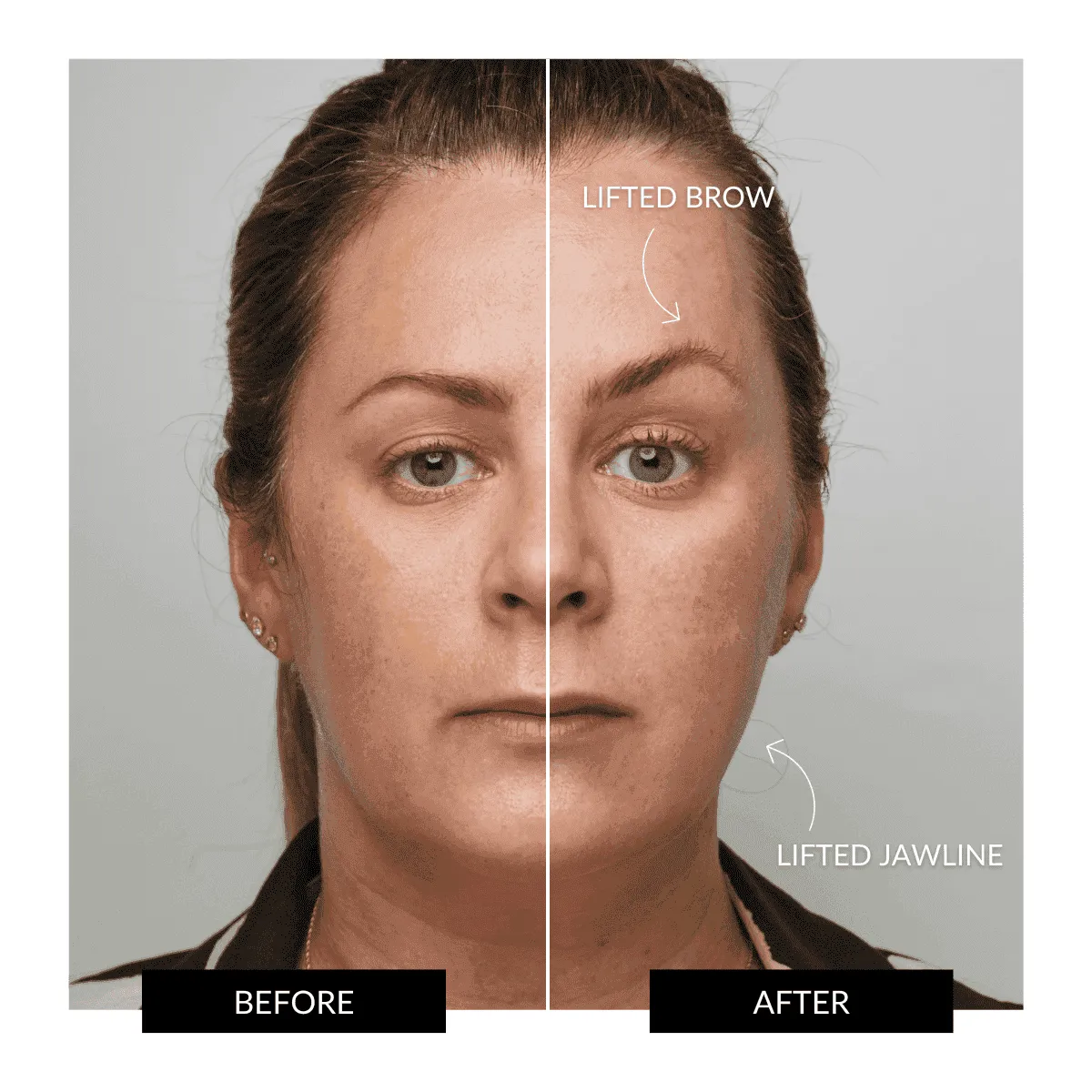 Offer - ZIIP HALO Nanocurrent Facial Toning Device