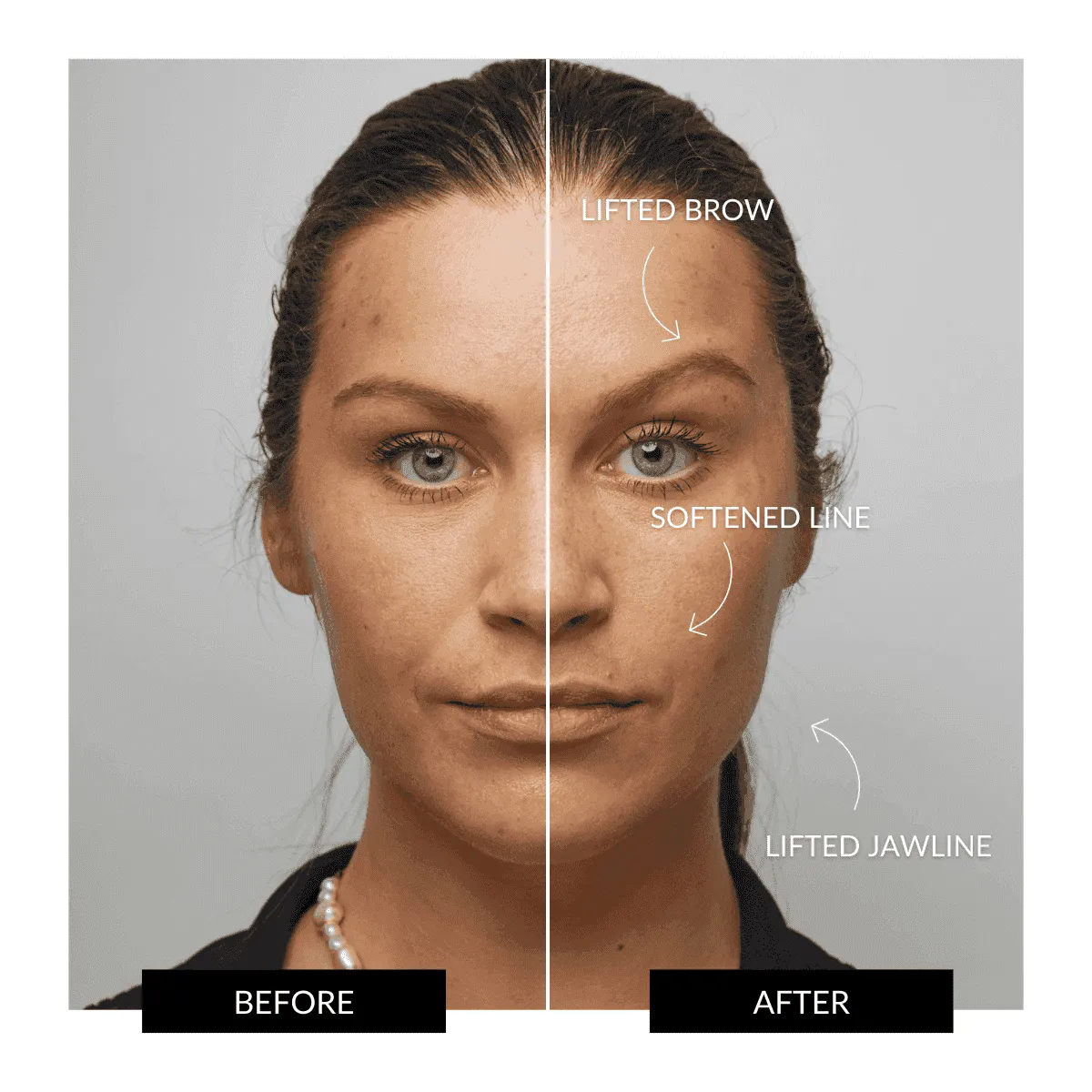 Offer - ZIIP HALO Nanocurrent Facial Toning Device