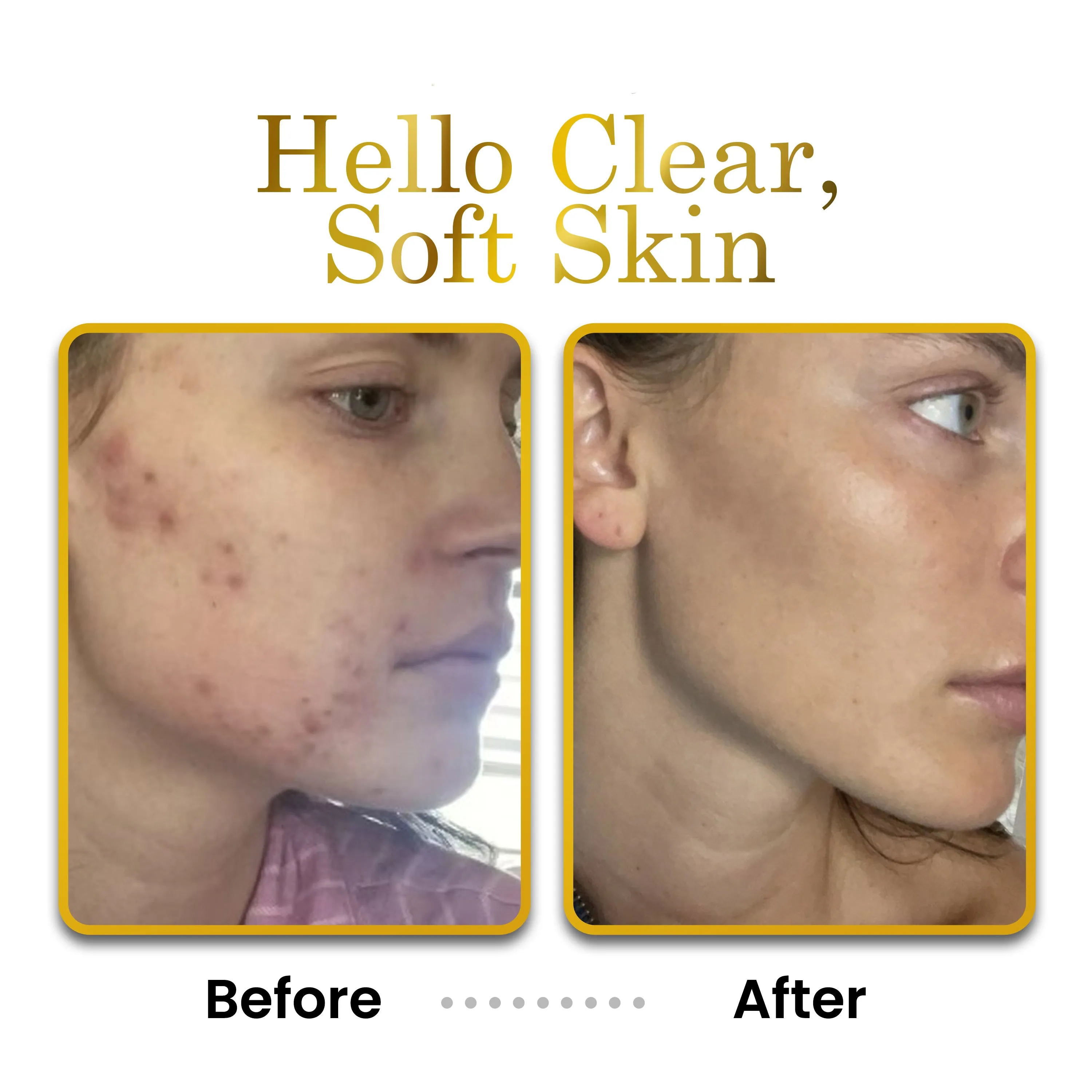 The Ultimate 4 in 1 Vegan Skin Cleanser